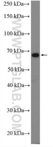 [25110-1-AP-150UL] BTNL2 Polyclonal antibody