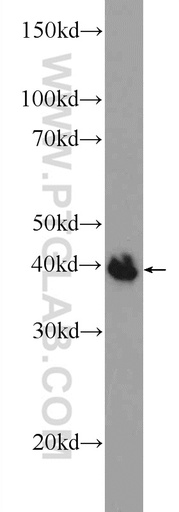 [25114-1-AP-20UL] POU3F4 Polyclonal antibody