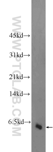 [25116-1-AP-20UL] GALP Polyclonal antibody