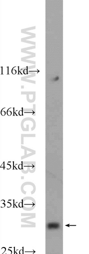 [25117-1-AP-20UL] SHOX Polyclonal antibody