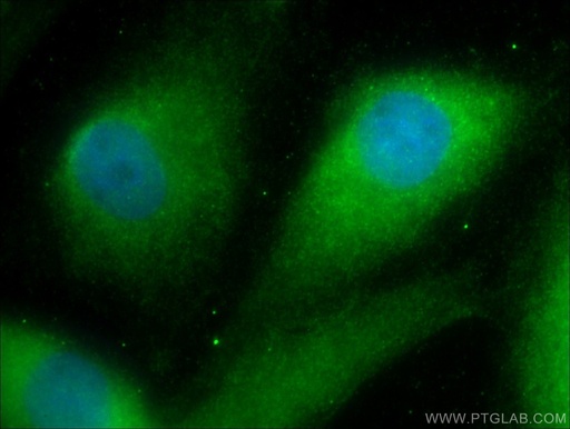 [25118-1-AP-150UL] DNAJB13 Polyclonal antibody