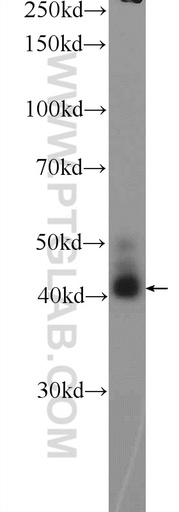 [25119-1-AP-150UL] AWAT2 Polyclonal antibody