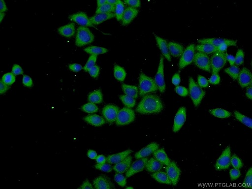 [25120-1-AP-150UL] TPTE2 Polyclonal antibody