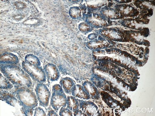 [25125-1-AP-20UL] FIBCD1 Polyclonal antibody