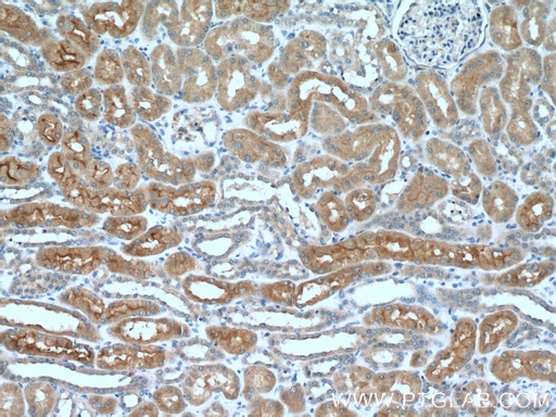 [25131-1-AP-20UL] AQP7 Polyclonal antibody
