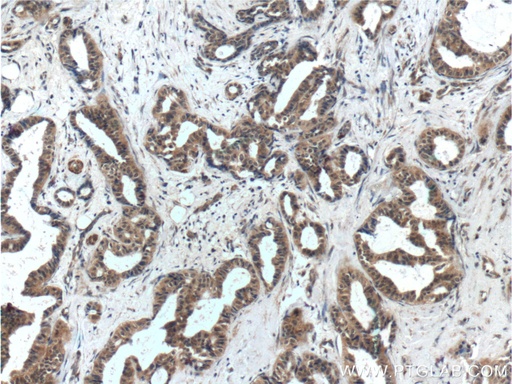 [25134-1-AP-150UL] WDFY3 / ALFY Polyclonal antibody