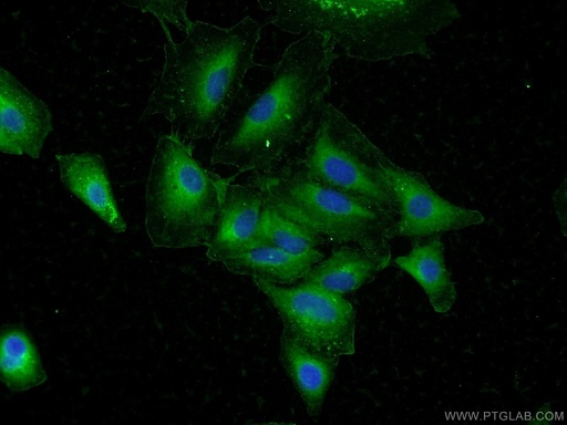 [25136-1-AP-150UL] DAPK1 Polyclonal antibody