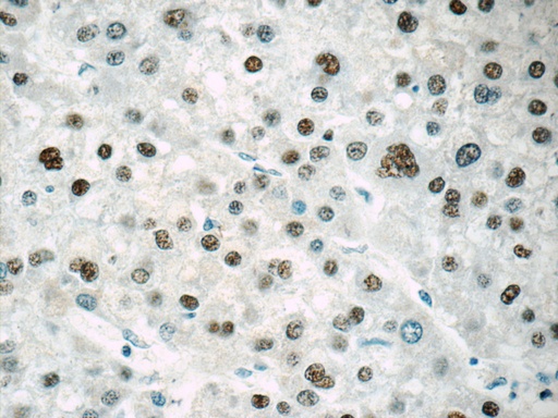 [25137-1-AP-20UL] ONECUT1 Polyclonal antibody