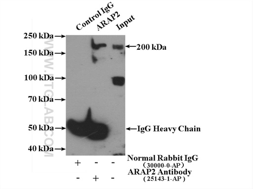[25143-1-AP-150UL] ARAP2 Polyclonal antibody