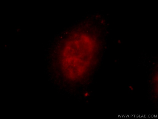 [25147-1-AP-20UL] ZNF326 Polyclonal antibody