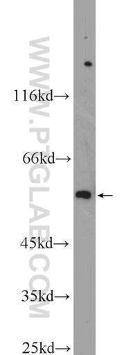 [25148-1-AP-20UL] TBX15 Polyclonal antibody