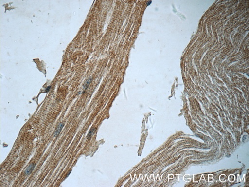 [25151-1-AP-150UL] SYNC Polyclonal antibody