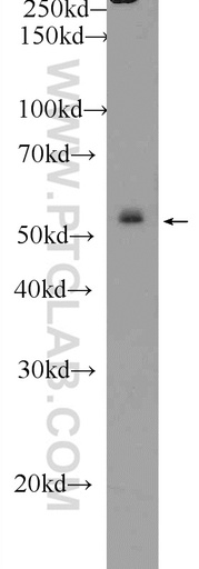 [25152-1-AP-20UL] ZNF253 Polyclonal antibody