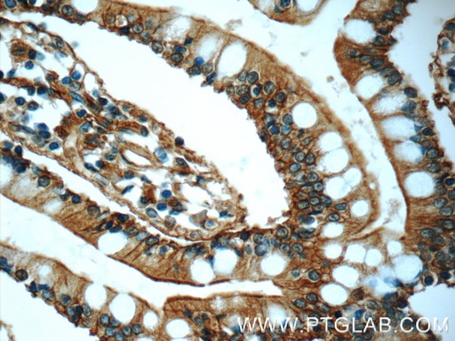 [25153-1-AP-20UL] Annexin A13 Polyclonal antibody