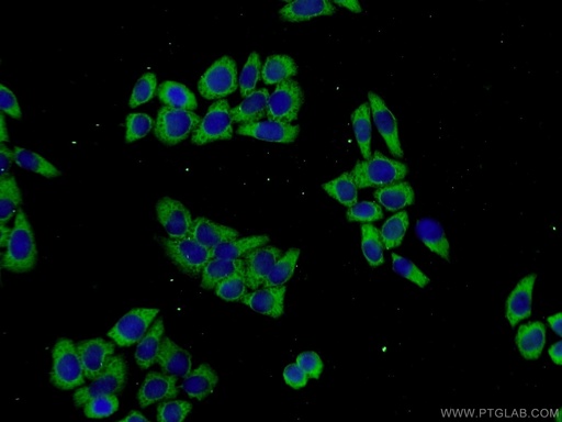 [25154-1-AP-150UL] PROSC Polyclonal antibody