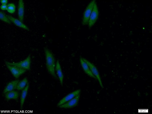 [25155-1-AP-150UL] ATG2B Polyclonal antibody