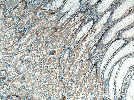 [25156-1-AP-150UL] EFCAB2 Polyclonal antibody