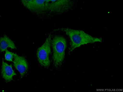 [25162-1-AP-20UL] DNAJC18 Polyclonal antibody