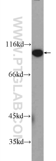 [25163-1-AP-150UL] FAM40B Polyclonal antibody
