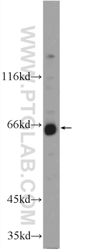 [25164-1-AP-150UL] WDR20 Polyclonal antibody