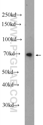 [25165-1-AP-150UL] RNF112 Polyclonal antibody