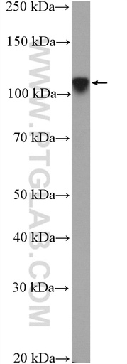 [25166-1-AP-150UL] ZNF711 Polyclonal antibody
