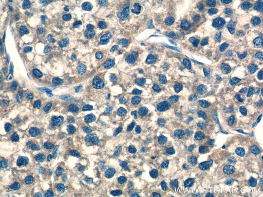 [25172-1-AP-150UL] NDUFS8 Polyclonal antibody