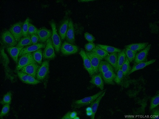 [25174-1-AP-20UL] QPRT Polyclonal antibody