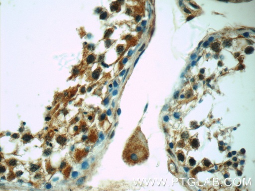 [25177-1-AP-150UL] C12orf54 Polyclonal antibody