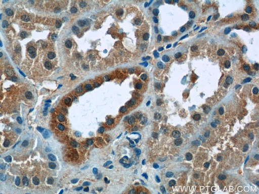 [25178-1-AP-20UL] ZNF497 Polyclonal antibody
