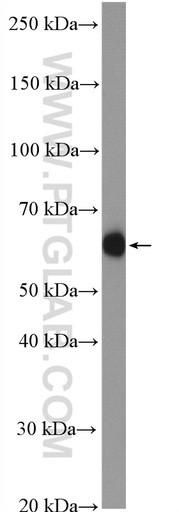 [25179-1-AP-150UL] HYAL1 Polyclonal antibody