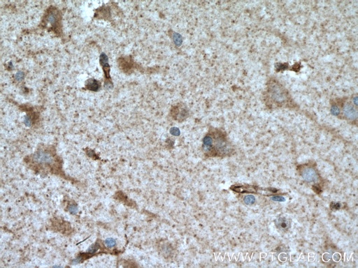 [25181-1-AP-20UL] ROBO1 Polyclonal antibody