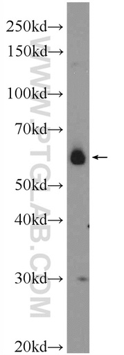 [25187-1-AP-150UL] CDC14B Polyclonal antibody