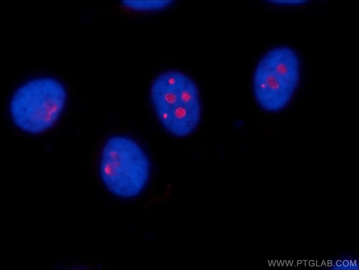 [25190-1-AP-150UL] RSL24D1 Polyclonal antibody