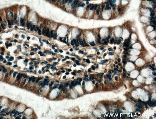 [25192-1-AP-20UL] FBP2 Polyclonal antibody