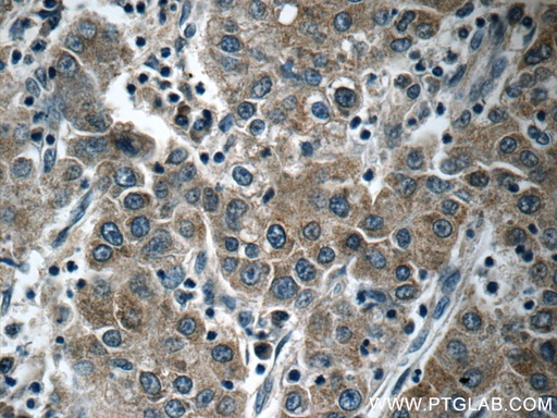 [25195-1-AP-150UL] KIAA0125 Polyclonal antibody