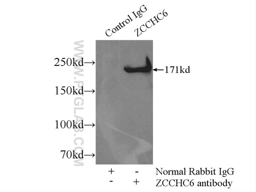 [25196-1-AP-20UL] ZCCHC6 Polyclonal antibody