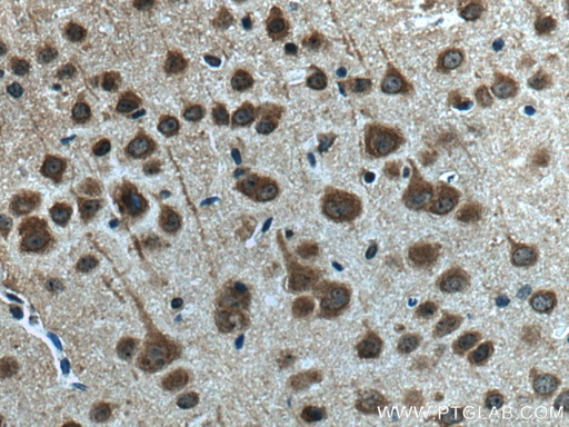 [25199-1-AP-150UL] AKAP12 Polyclonal antibody