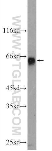 [25200-1-AP-150UL] ZIM3 Polyclonal antibody