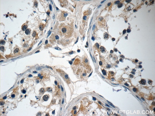 [25202-1-AP-150UL] ANKRD33 Polyclonal antibody