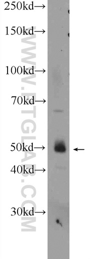 [25204-1-AP-20UL] WIPI1 Polyclonal antibody