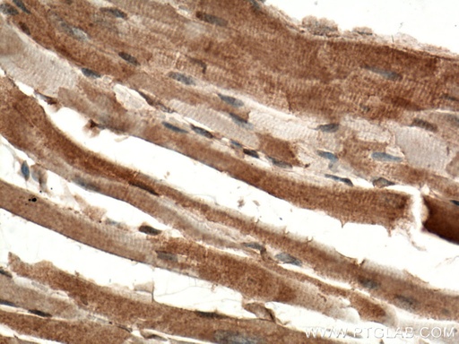 [25206-1-AP-20UL] DAAM2 Polyclonal antibody
