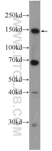 [25215-1-AP-150UL] ZBTB11 Polyclonal antibody