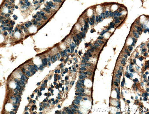 [25218-1-AP-20UL] USE1 Polyclonal antibody