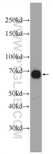 [25219-1-AP-20UL] DACH2 Polyclonal antibody
