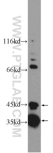 [25220-1-AP-20UL] SLMAP Polyclonal antibody