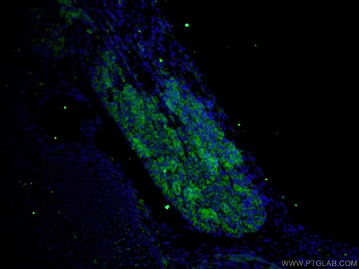 [25222-1-AP-20UL] DTX4 Polyclonal antibody