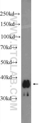 [25223-1-AP-150UL] UCP5 Polyclonal antibody
