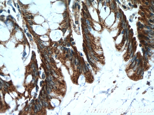 [25224-1-AP-150UL] KLHL28 Polyclonal antibody