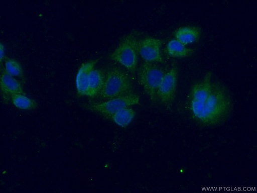 [25225-1-AP-150UL] Galectin 10 Polyclonal antibody